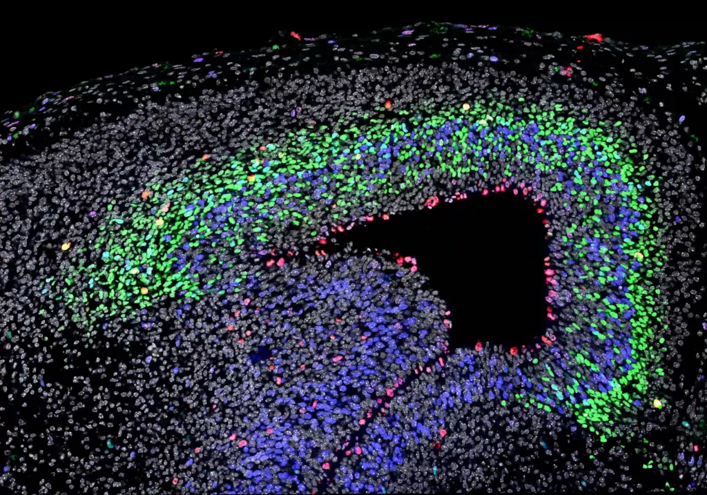 Images travaux sur Croissance et développement du néocortex